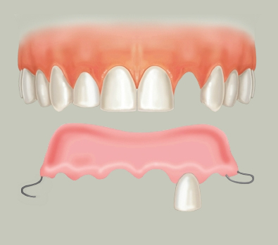dentures for missing teeth