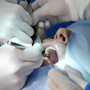 surgical extraction